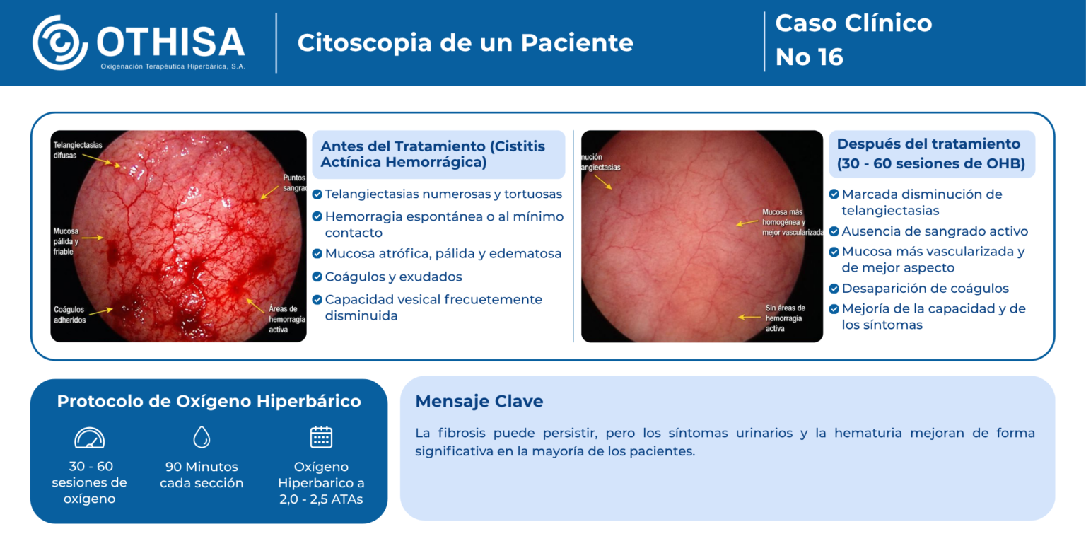 Caso Clínico 16 Citoscopia de un Paciente