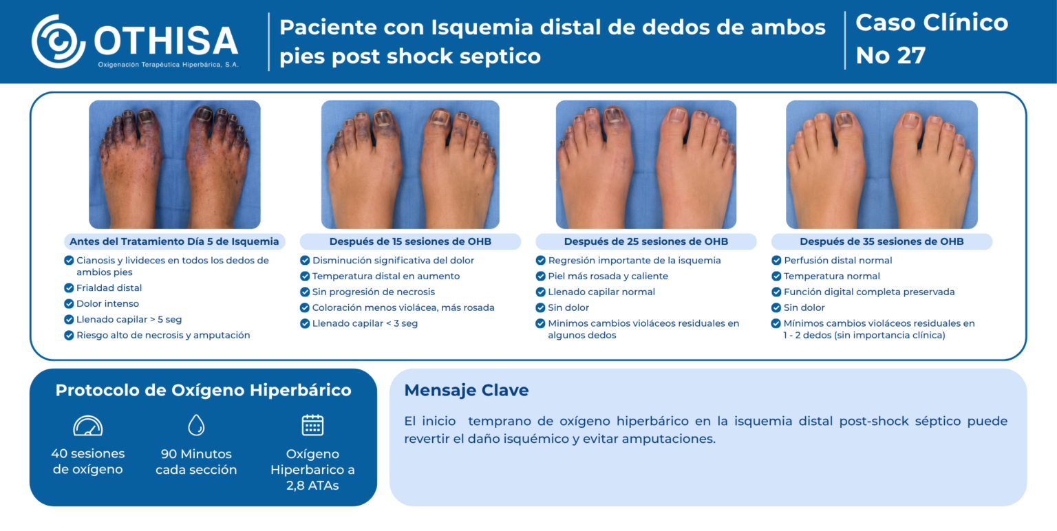 Caso Clínico 27 Paciente con Isquemia distal de dedos de ambos pies post shock septico