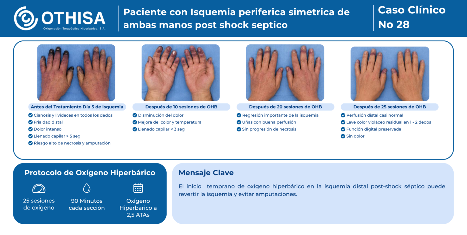 Caso Clínico 28 Paciente con Isquemia periferica simetrica de ambas manos post shock septico
