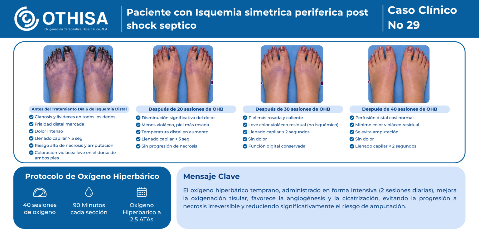 Caso Clínico 29 Paciente con Isquemia simetrica periferica post shock septico