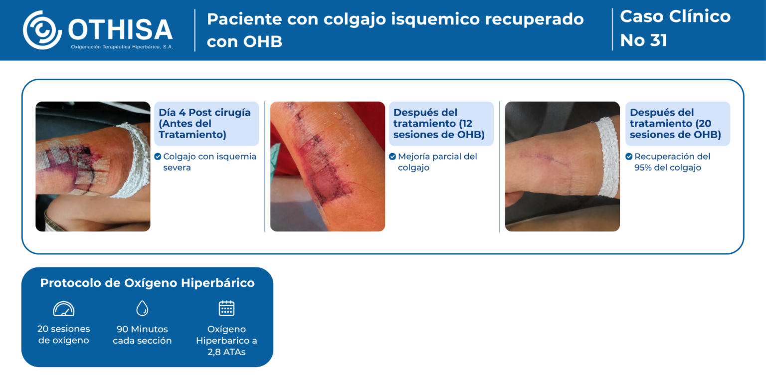 Caso Clínico 31 Paciente con colgajo isquemico recuperado con OHB