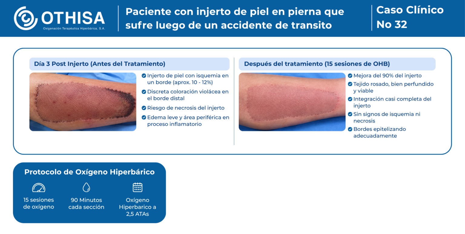 Caso Clínico 32 Paciente con injerto de piel en pierna que sufre luego de un accidente de transito