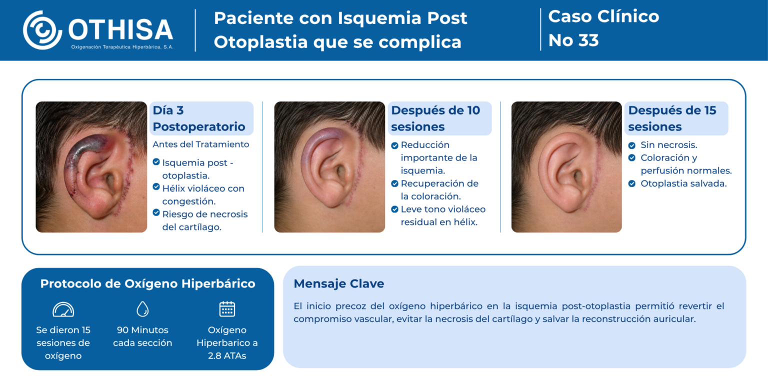 Caso Clínico 33 Paciente con Isquemia Post Otoplastia que se complica