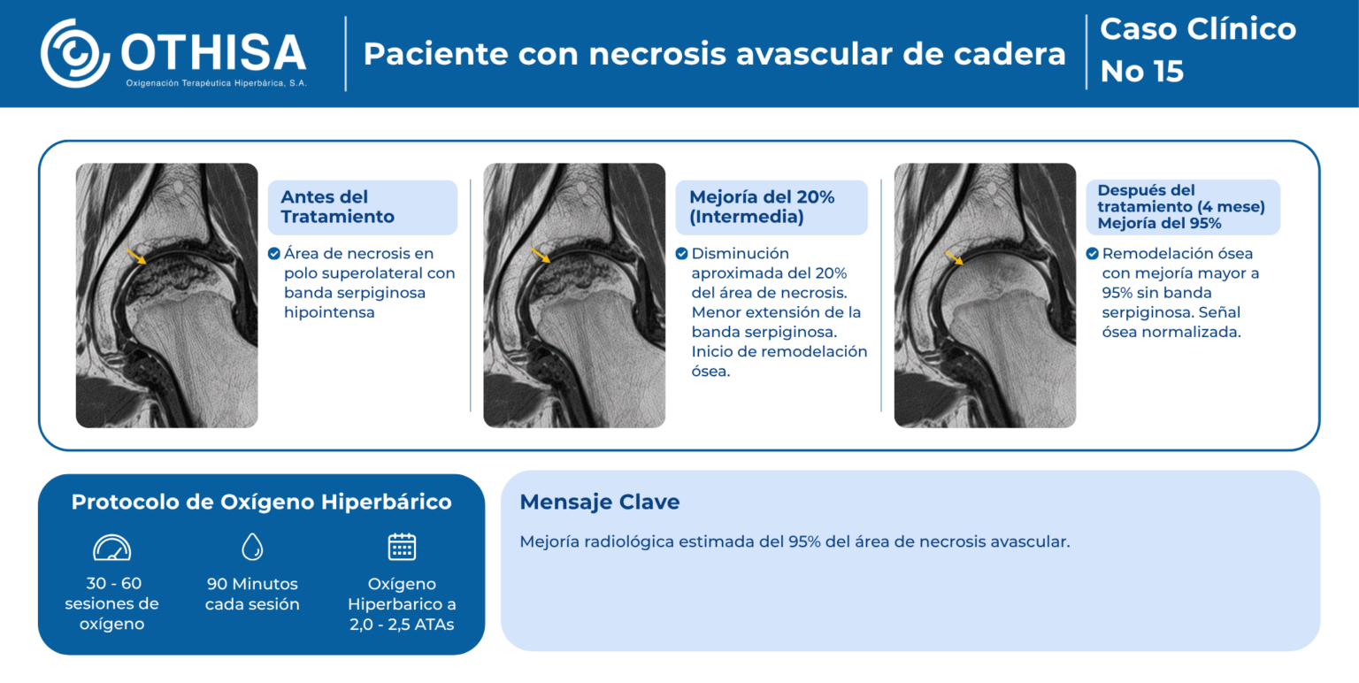 Caso Clínico 15