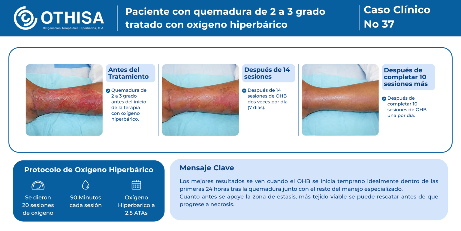 Caso Clínico 37