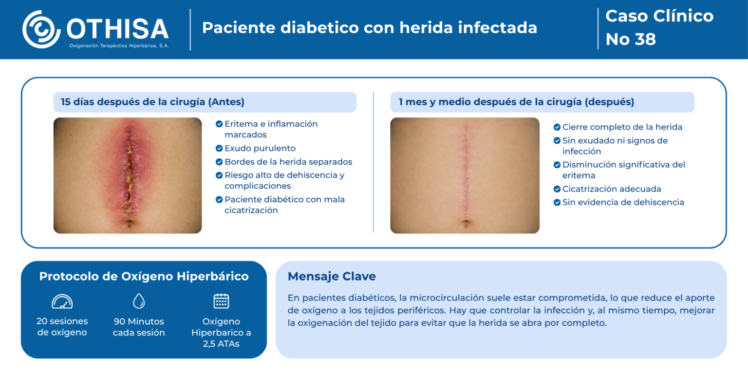 Caso Clínico 38