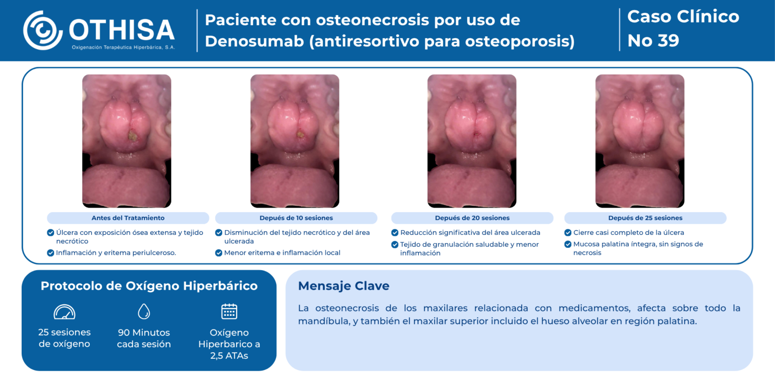 Caso Clínico 39