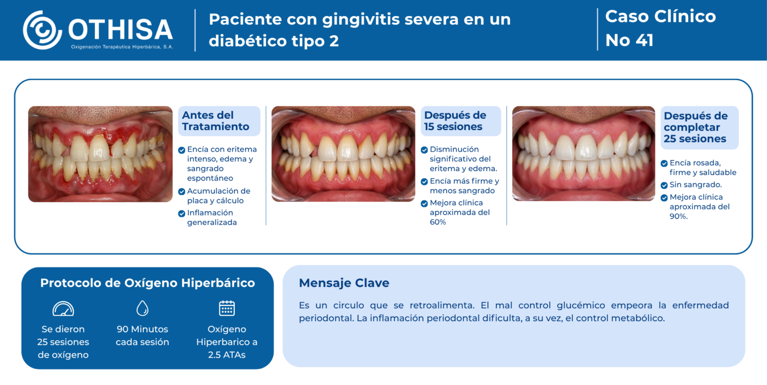 Caso Clínico 41