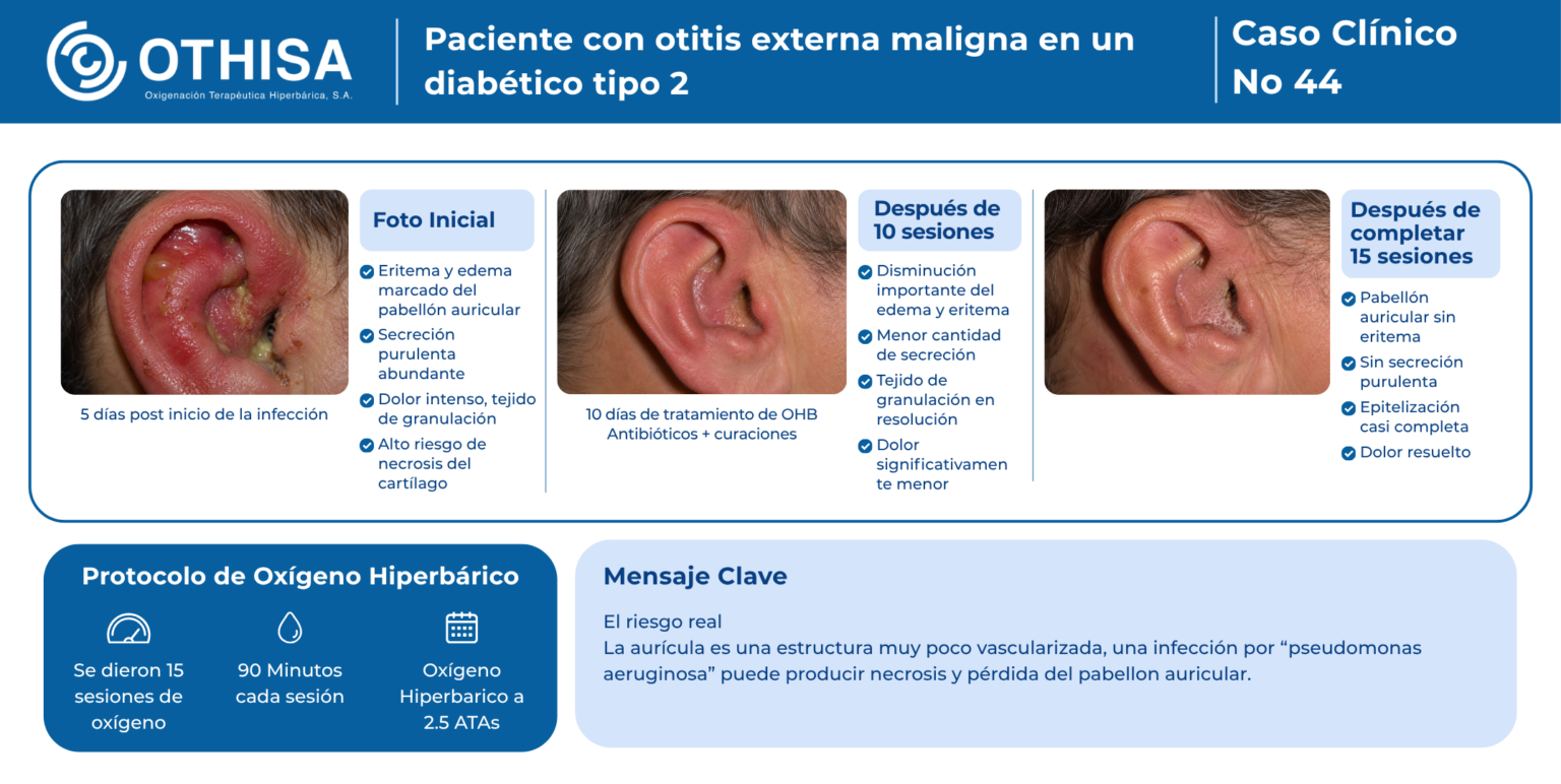 Caso Clínico 44