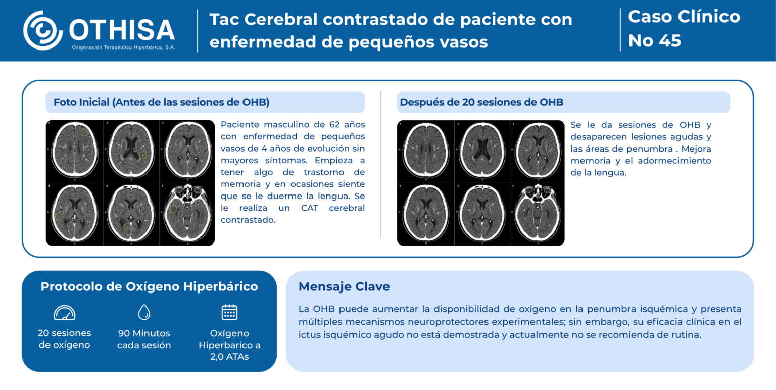Caso Clínico 45