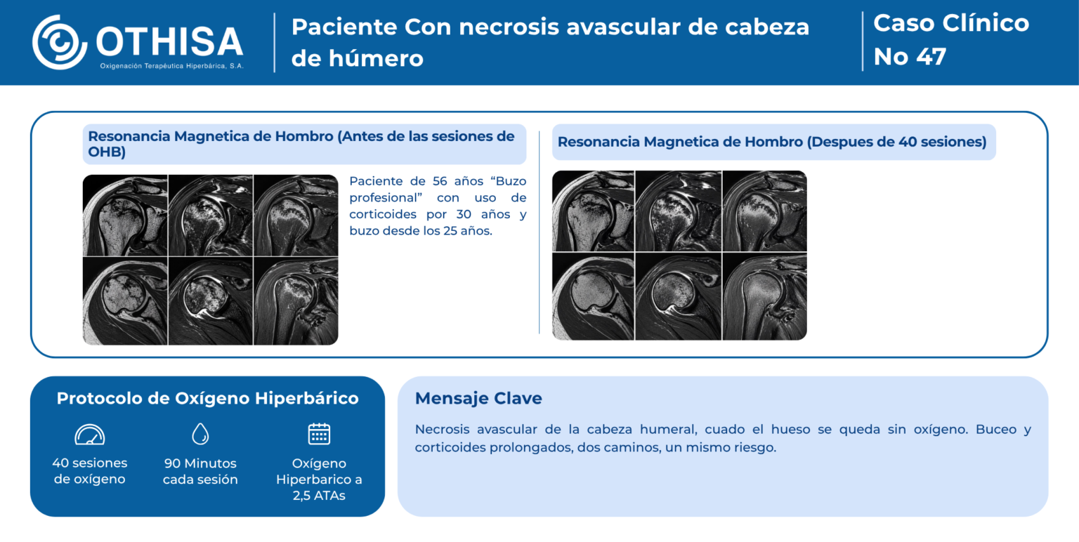 Caso Clínico 47