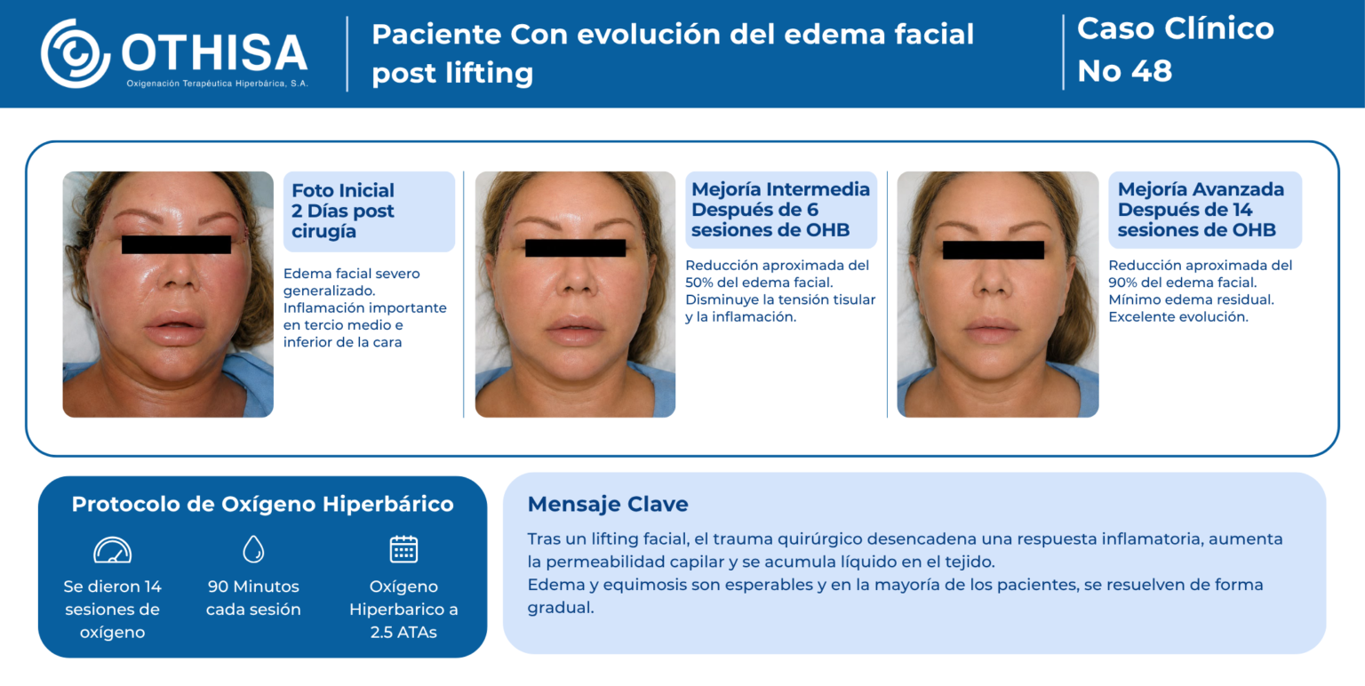 Caso Clínico 48