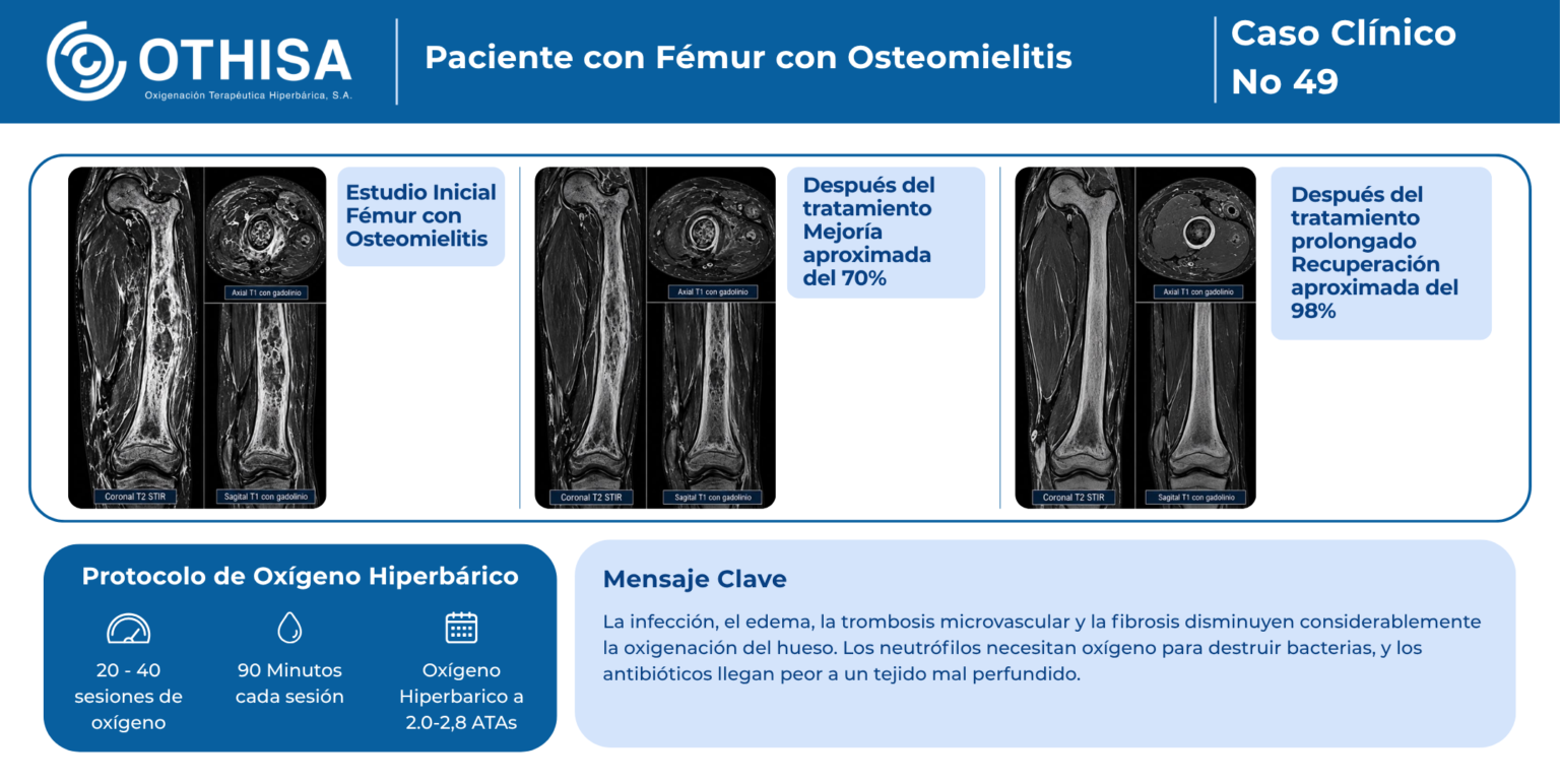 Caso Clínico 49