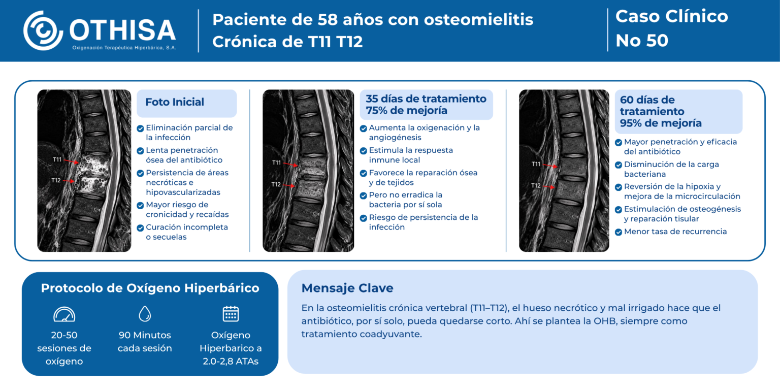 Caso Clínico 50